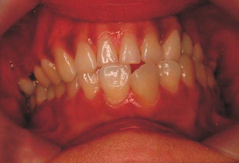 Case 1 A 39-year-old woman visited the clinic complaining of facial asymmetry.