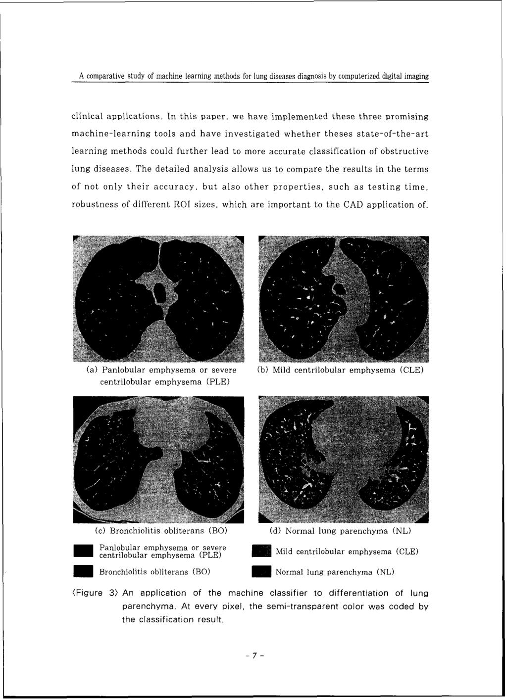 A comparative study of machine learning methods for lung diseases diagnosis by computerized digital imaging clinical applications.