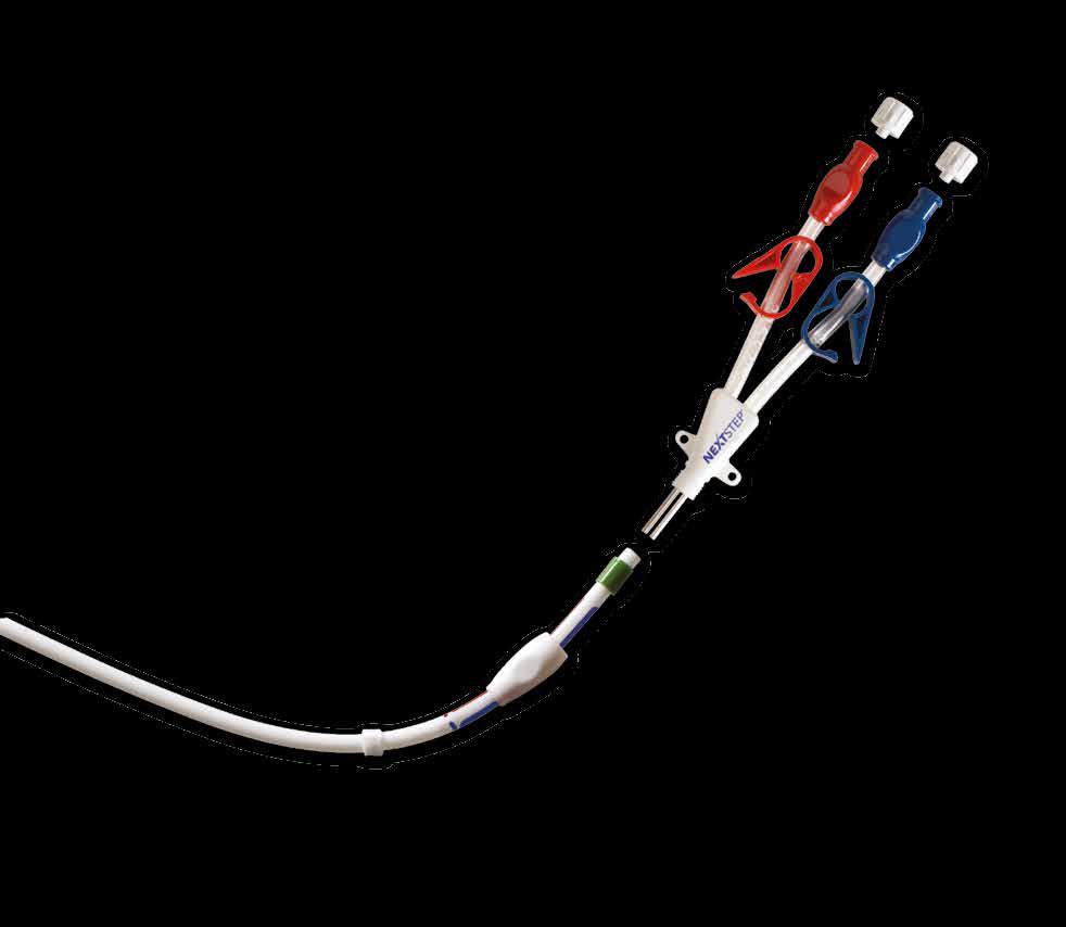 Chronic dialysis 7 REVERSED PORTS to help deliver sustained high flow, the arrow NextStep Retrograde ports are reversed: the venous port resides in the