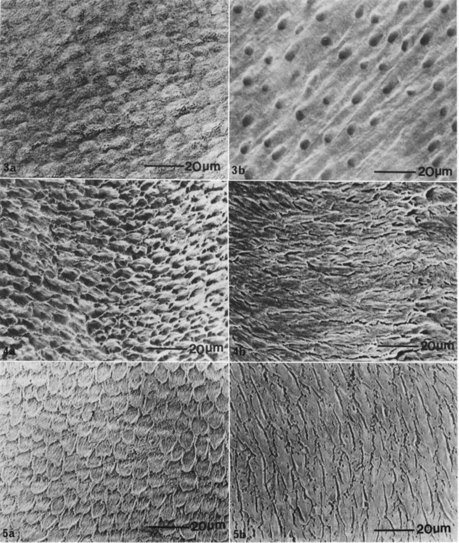 Fig. 3.-Scanning electron micrograph of enamel (a) and dentine (b) treated with a commercial polyacrylic acid. Fig. 4.