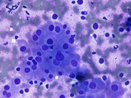 follicular cells lymphocytes, PMNs and macrophages