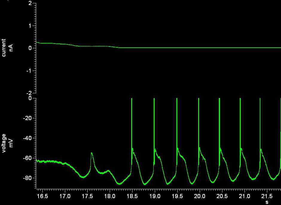 : -55mV B: -60mV, B, C show responses at different membrane potentials to a similar 0.3n depolarising current pulse. C: -70mV 0.