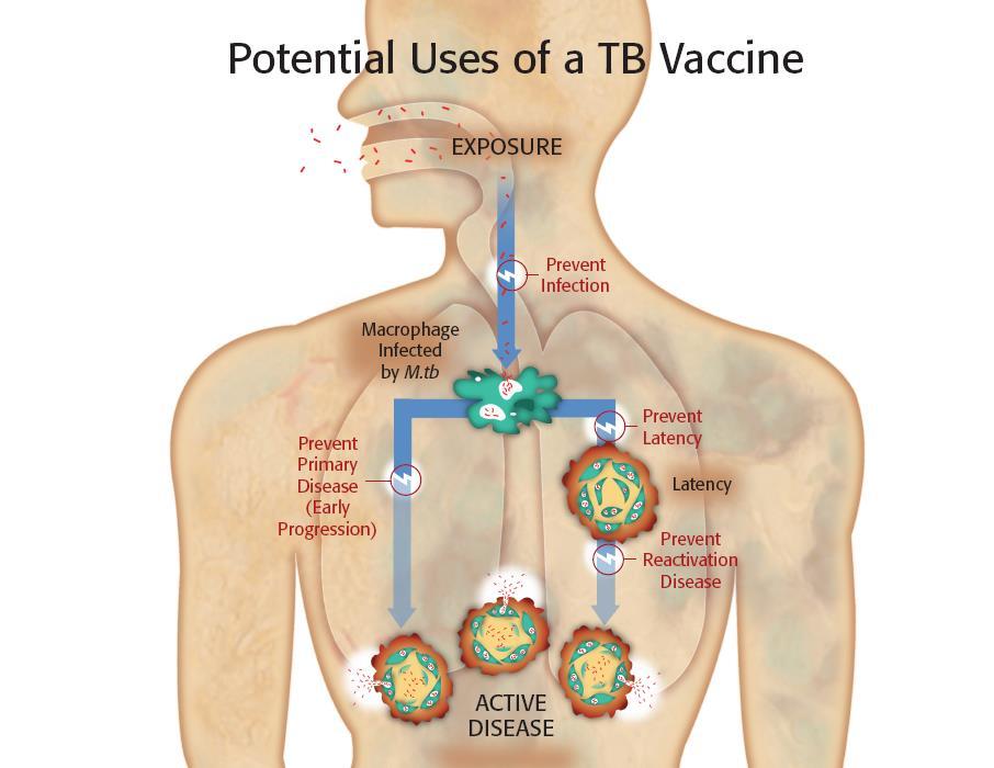 TB vaccines: the future?