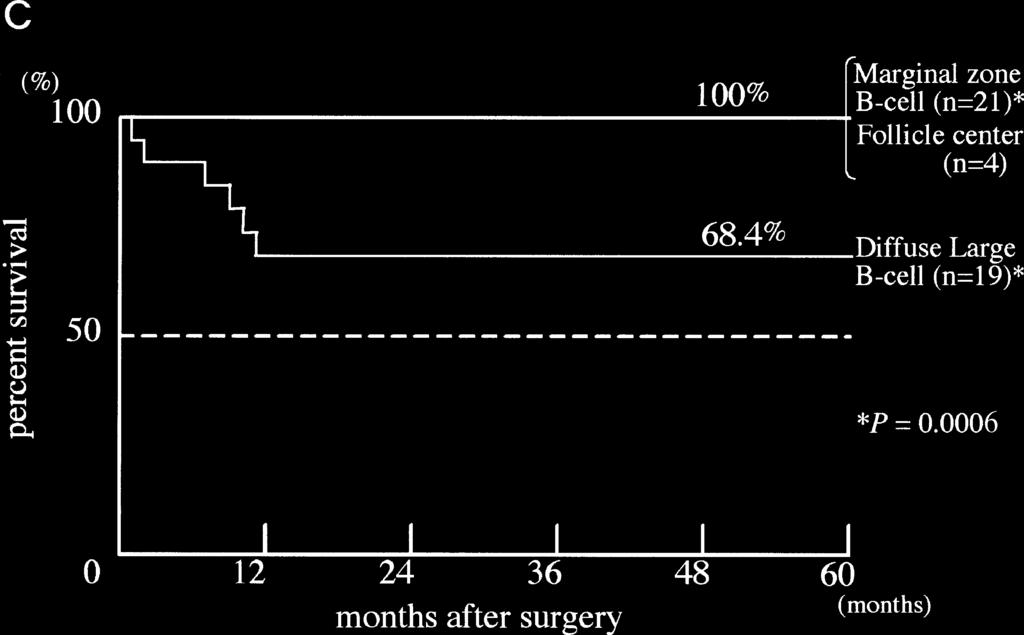 C Kaplan Meier survival curves for patients with gastric NHL, classified by the revised European-American lymphoma (REAL) system: i.e., marginal-zone B-cell (MZBL), follicle center, or diffuse large B-cell lymphomas.