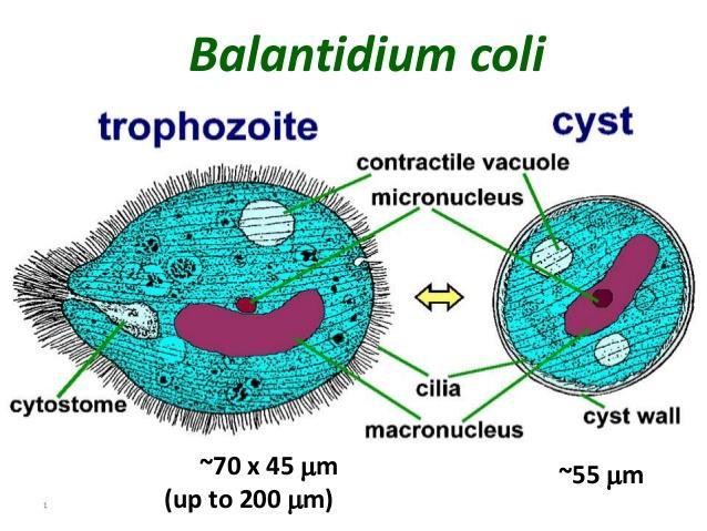 Ciliates Balantidium coli is the only ciliate known to cause disease in humans Commonly found in animal intestinal tracts Humans become infected by consuming food or water contaminated with feces