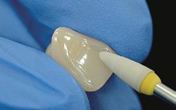 otherwise, it will cause cracks. Polish the zirconia surface which might contact to the opposing tooth.