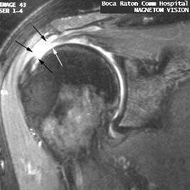 Ultrasound MRI