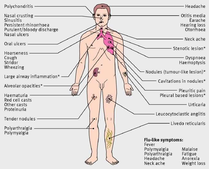 Clinical features