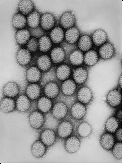 Reovirus (RNA) Rotavirus VP7 and VP4 antigens define virus serotype and induce neutralizing antibody 5 predominant strains in US (G1- G4,
