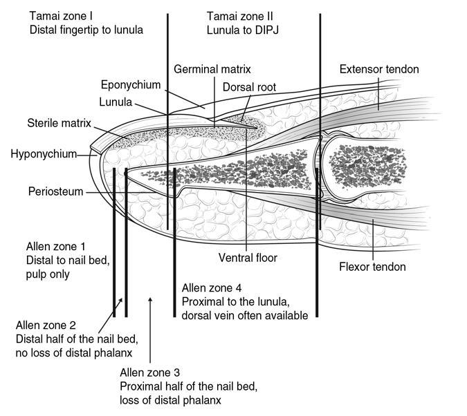 Anatomy Germinal matrix Sterile