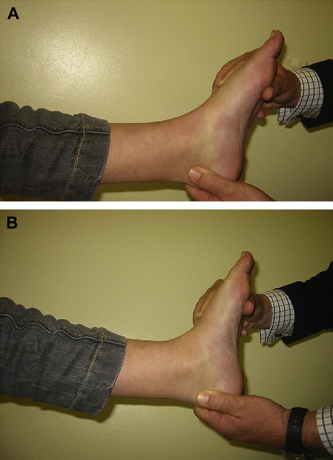 Operative Treatment When surgery is considered for treating calf contracture, the technique must be appropriate for the type of contracture.