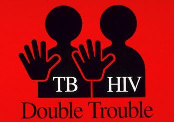 TB is the number one killer of HIV patients, accounting for more than 25% of HIV-associated deaths.