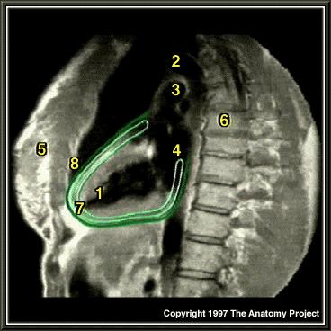 Lateral MRI 1.Left ventricle 2.Aorta 3.Pulmonary trunk 4.Left atrium 5.Breast 6.
