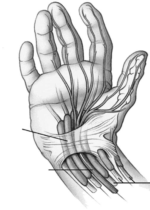 Median nerve Transverse carpal ligament Tendons Median nerve Retinaculum Tendons Flexor tendons Carpal (wrist) bones What caused Carpel Tunnel?
