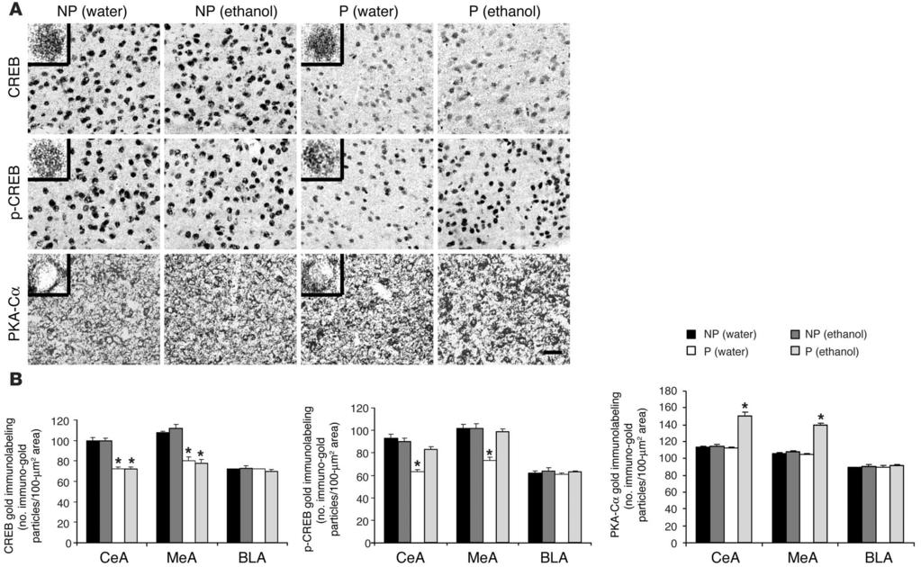 Figure 2 Voluntary ethanol intake and CREB signaling in the amygdala of P and NP rats.