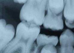 your teeth and gums are healthy. What to expect.