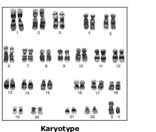 Karyotype Karyotype a picture of the paired homologous chromosomes, taken during Prophase (sometimes Metaphase) of Mitosis, arranged from largest chromosome to