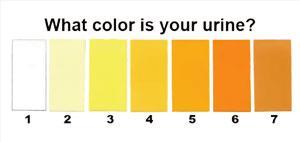What should my urine look like? Urine should be a light yellow colour. If it is orange/dark brown, you may not be drinking enough fluid.