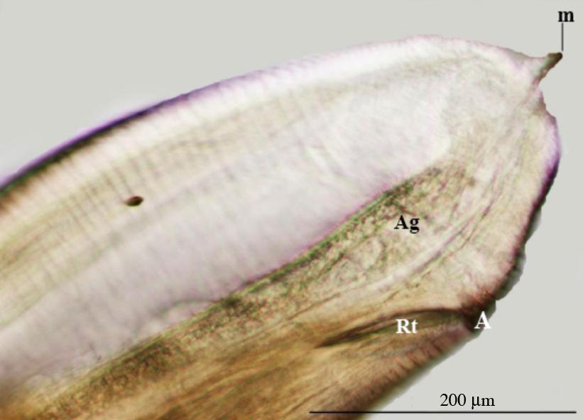 Southeast Asian J Trop Med Public Health E G Fig 1E Stereomicrograph shows the middle part of the body composed of grooves (G) with intervening ridges (R).