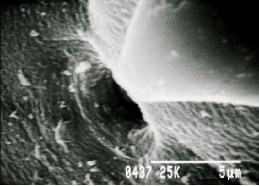 There was an anal opening on the ventral surface of the tip of the tail, triangular in shape (Fig 2L, 2M). The width of the anal opening was 14-16 µm.