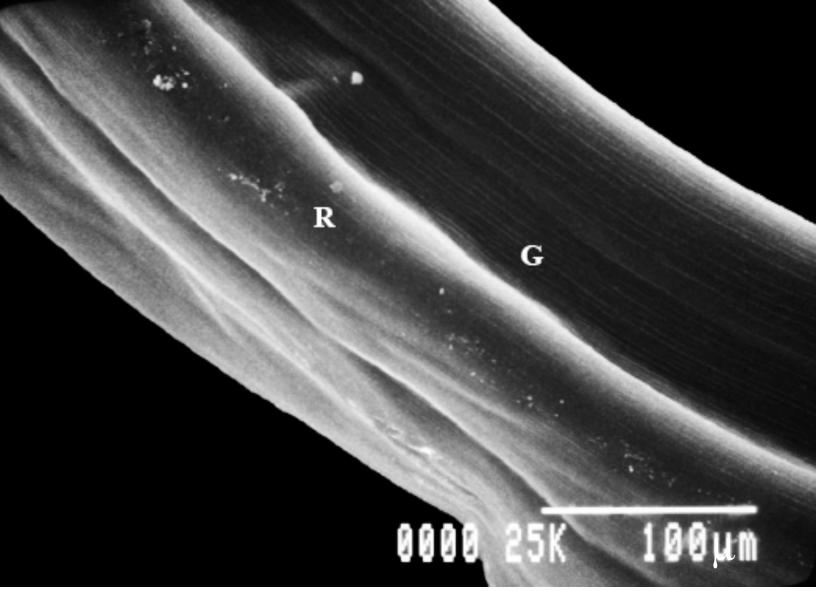 I K Fig 2I Scanning electron micrograph shows the posterior part of the body. The grooves (G) with ridges (R) are present on the outer surface of the body.