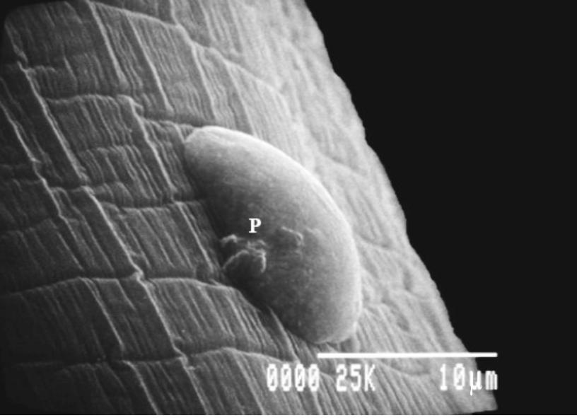 It is slender, elongated, whitish yellow, has bilateral symmetry, is cylindrically shaped Fig 2L Scanning electron micrograph shows a higher magnification of the posterior end.