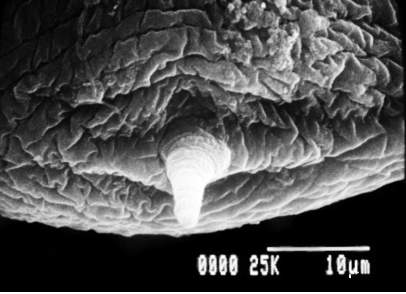 P Fig 2N Scanning electron micrograph shows the tail of the worm. Fig 2P Scanning electron micrograph shows the tip of the mucron.