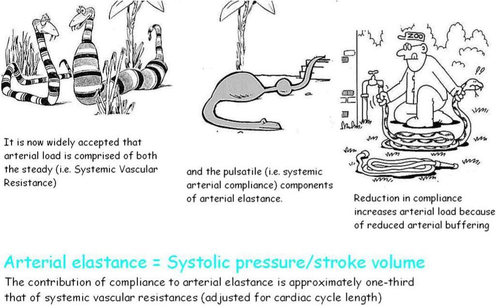 The steady (Systemic Vascular Resistance) and the pulsatile (Systemic Arterial Compliance) components of Arterial Elastance.