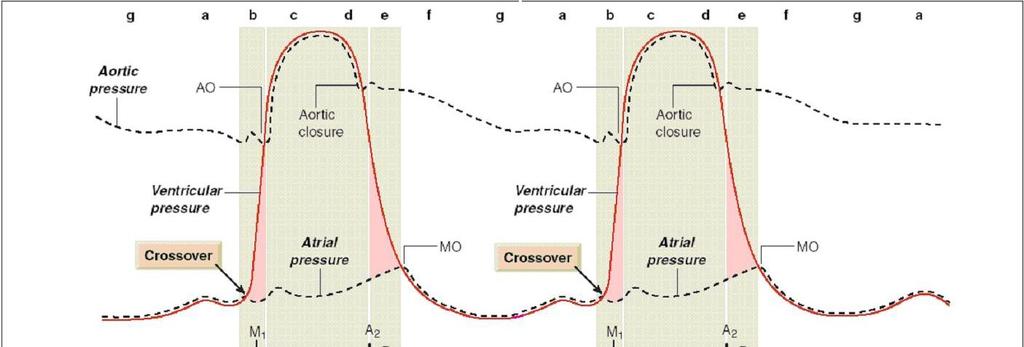 The mechanical events in the cardiac cycle.