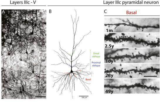 Branching of pyramidal neurons in the frontal