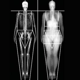 Composition The Total Body exam, the ultimate in skeletal assessment, provides precise bone density and body composition (total fat, lean and bone tissue) results in one