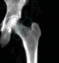 applications available for the Prodigy Advance bone densitometer.