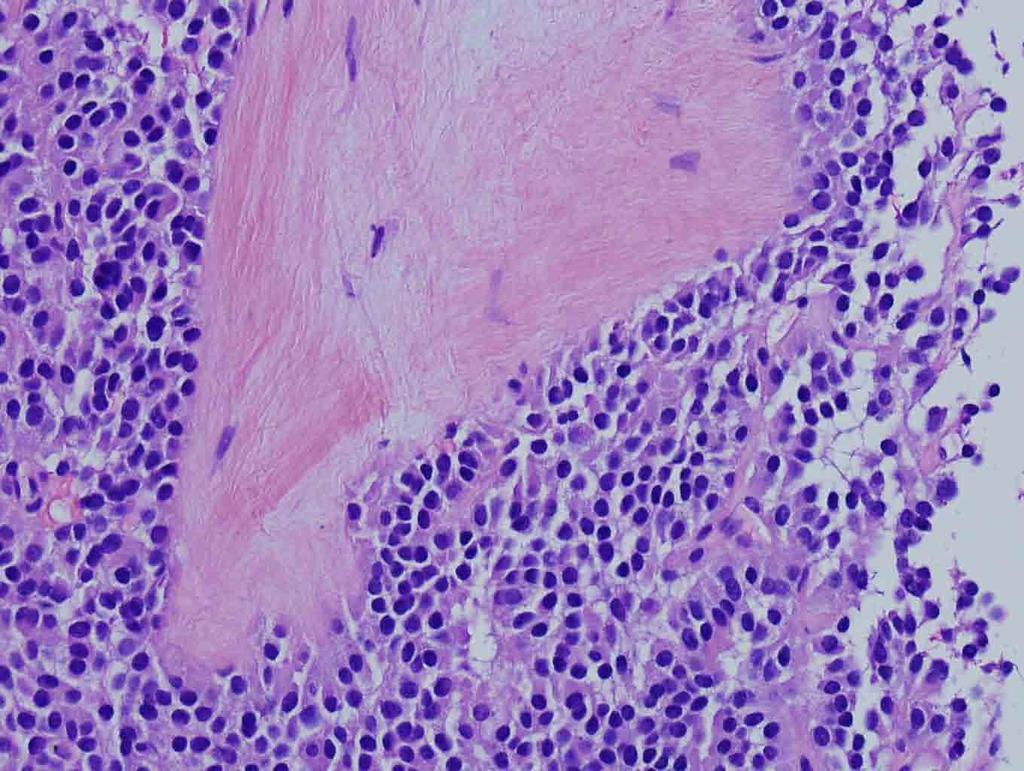 Liver, left lobe, core needle biopsy: H & E stain, 20x Presentation material is
