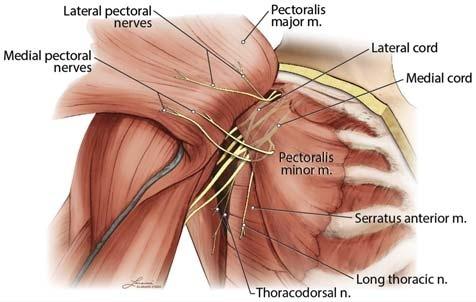 Regional Anesthesia and Pain Medicine Volume 42, Number 5, September-October 2017 FIGURE 6. Diagram of pectoral nerves.