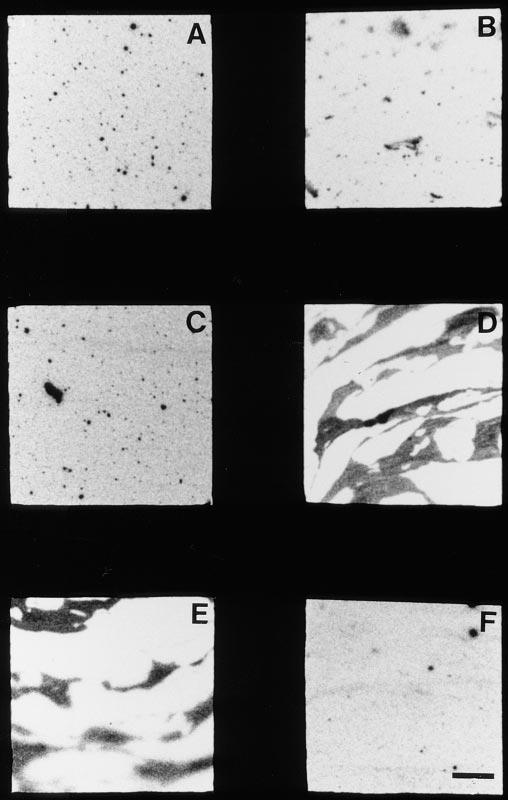 Fig. 5. Langmuir-Blodgett films of mixed DPPC/cholesterol monolayers. All films were deposited in the rhomboid surface balance with constant surface tension of 23 24 mn/m at 37 C except for graph F.
