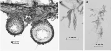 Figs. 11-13. Lanatonectria oblongispora. 11. Perithecia on substrate in section, HMAS 91743; 12. An ascus with ascospores, HMAS 91742; 13. Ascospores, HMAS 91742.