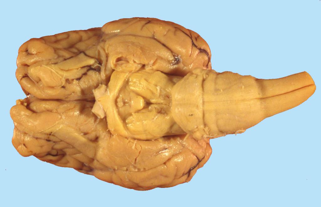 Nerves Lobe Longitudinal Fissure Spinal Cord Cerebral Cortex Parietal Lobe Corpus Callosum Ventricle Occiptal Lobe Brain Stem