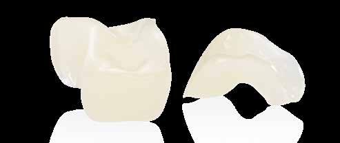 NEW Tetric CAD Composite Tetric CAD is an esthetic composite block for the efficient fabrication of single-tooth restorations.