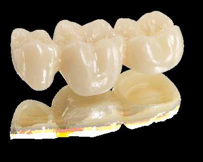 Its formulation has been optimized to make it particularly suitable for use in conjunction with restorations made of IPS e.