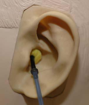 Place the earphones on the patient s head so the center of the earphone is directly