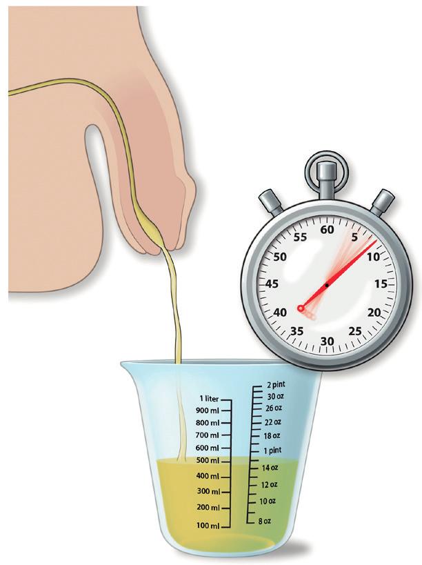 Prostate Rectum What measuring your urine flow rate at home can tell you: Normal urine flow is above 15 millilitres per second.