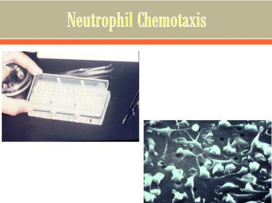 In the wells is NFMLP You plate the neutrophils on