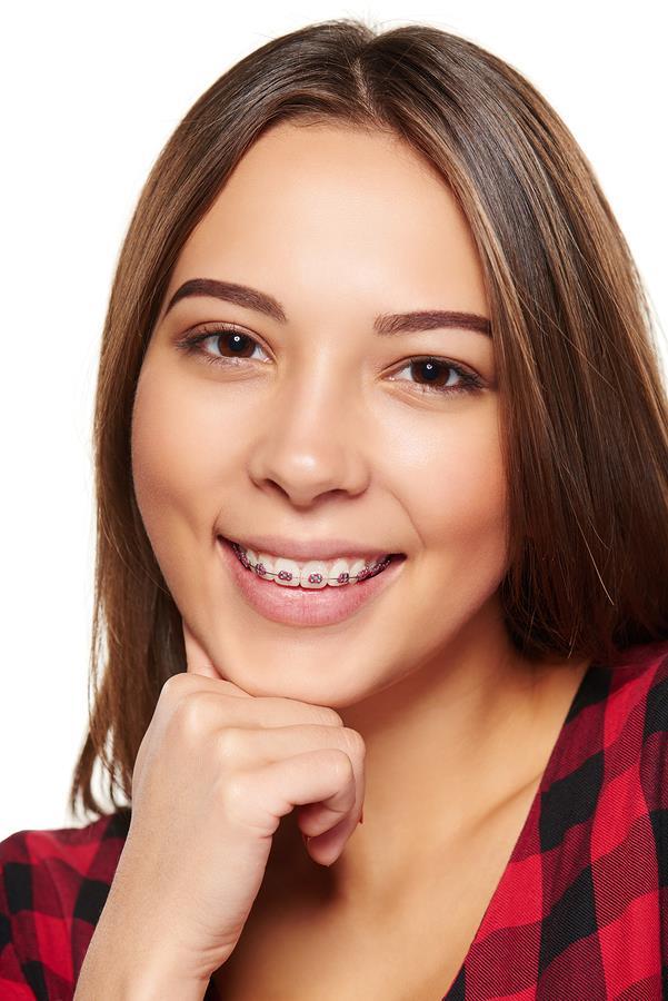 5 DO THEY OFFER SAME DAY BRACES? With work, school, and extracurricular activities, time is an important factor when it comes to things like orthodontic appointments.