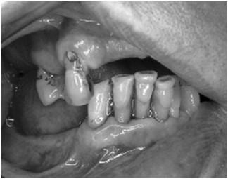 WM Epidemiology of oral health conditions in