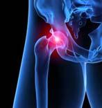 Rule out Referred Pain from Hip Specialty Tests Meniscus Thessaly McMurray Anterior Cruciate Ligament Lachman Pivot Shift Anterior Drawer Patella Q angle J sign Patella apprehension Patella Load