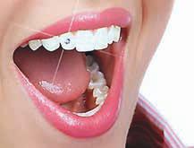 Bleaching or Teeth Whitening Procedures Pink Component (Gums & Lips) Gingivectomy / Gingivoplasty Gingival Grafting & Pink Colored Composite Restoration Gingival Depigmentation Gummy Smile