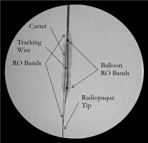 6. Advance the PTA balloon catheter until resistance is felt and the PTA balloon catheter is fully advanced near the distal RO band of the SplitWire device.