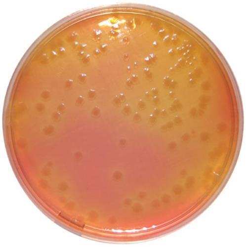 (Salmonella Shigella Agar) This agar is Red (pinkish) in colour.