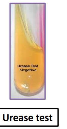 Urease test- Salmonella is Urease Negative.