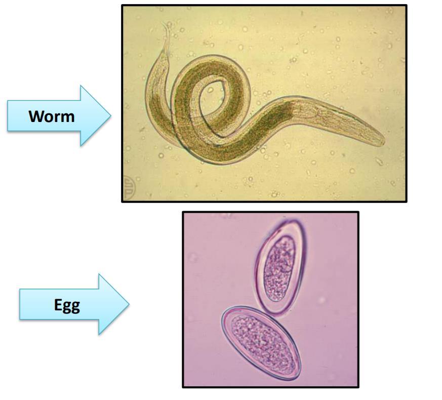 Enterobius Vermicularis Known as the Pinworm.